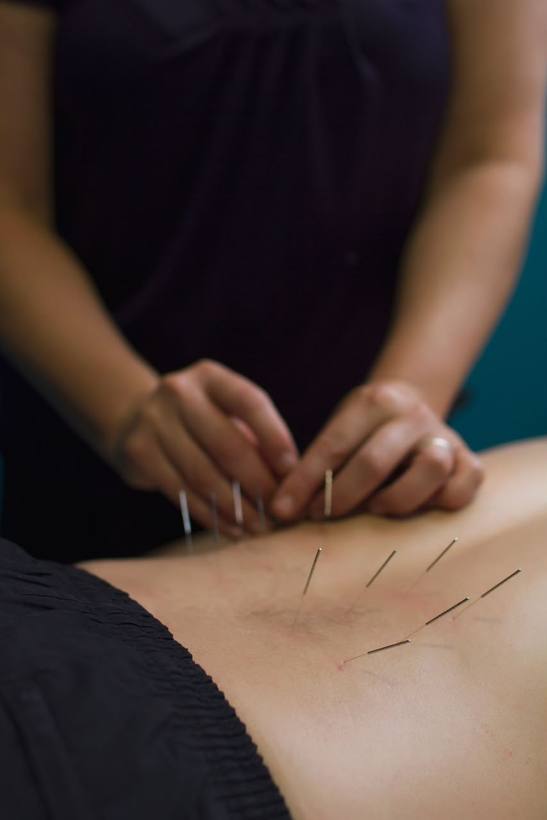 Acupuncture at Saamya, Nashik